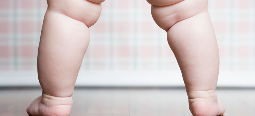 Βρεφική Παχυσαρκία Βρεφική Παχυσαρκία